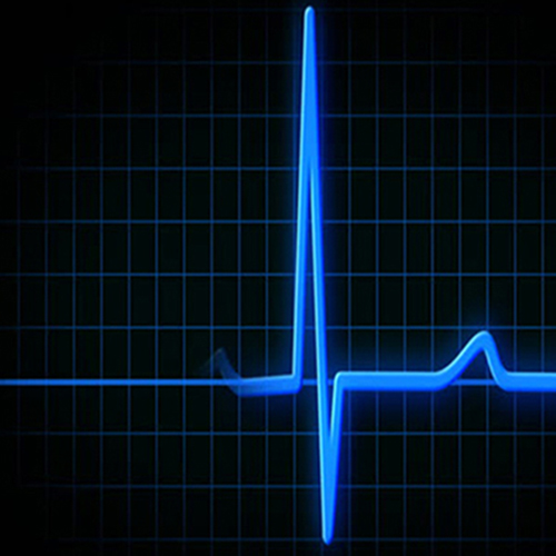 ecg